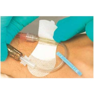 TIDI Products 3300M - DEVICE, CATHETER, GRIP, ADHESIVE, 100 EA/CS