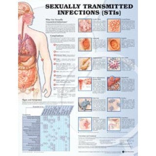 Wolters Kluwer Health 1587798506 - chart sex transmitted infect. flex 20x26 Ea