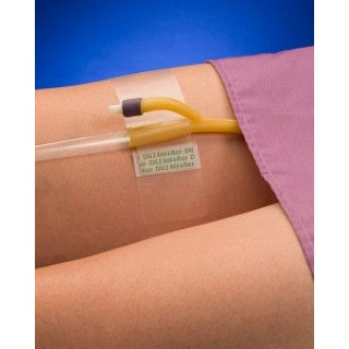 Dale Medical H84101501 - Hold-n-Place Foley Catheter Holder, Adhesive Patch, 50/CS