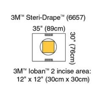 3M 6657 - Steri-Drape Pouch with Ioban 2 Incise Film, Incise area: 11" x 11" (30cm x 30cm), 10/BX, 4 BX/CS